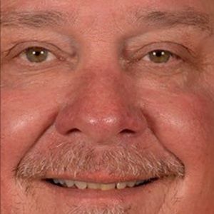 Meet your Posher, Joe